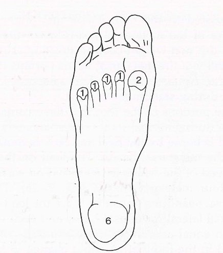 Image of load points of the foot.